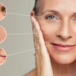¿Cómo se da el envejecimiento de la piel?